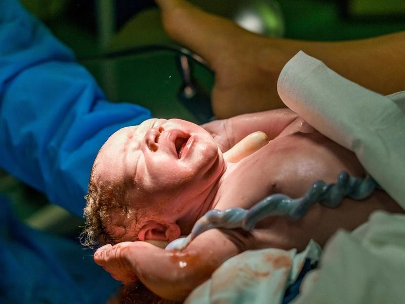 Pępowina – USG, nieprawidłowości i pielęgnacja po porodzie