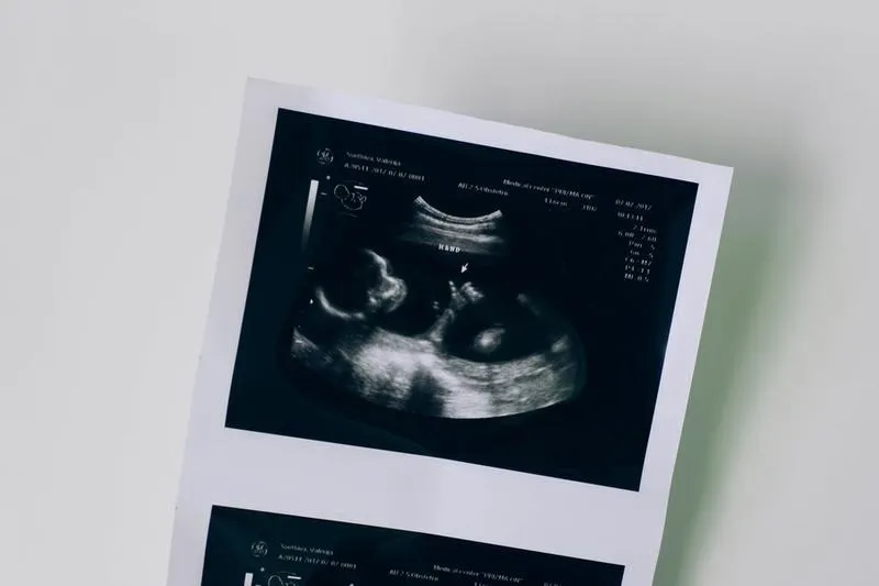 Trzecie USG w ciąży: kiedy je wykonać i jak przygotować się do porodu?