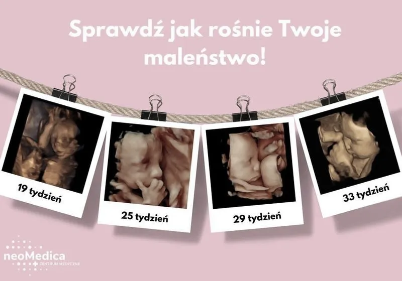 USG w 6. tygodniu ciąży – kiedy widać zarodek i tętno?