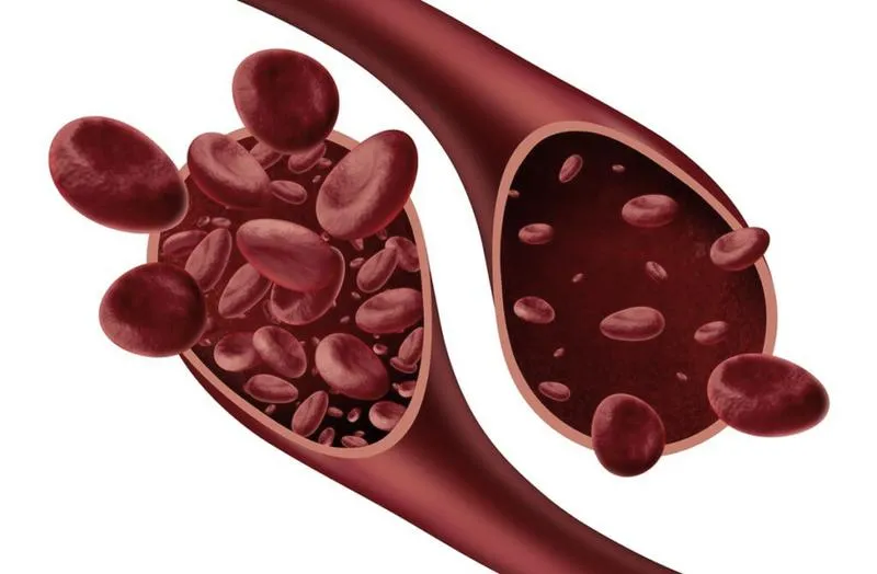 Anemia w ciąży