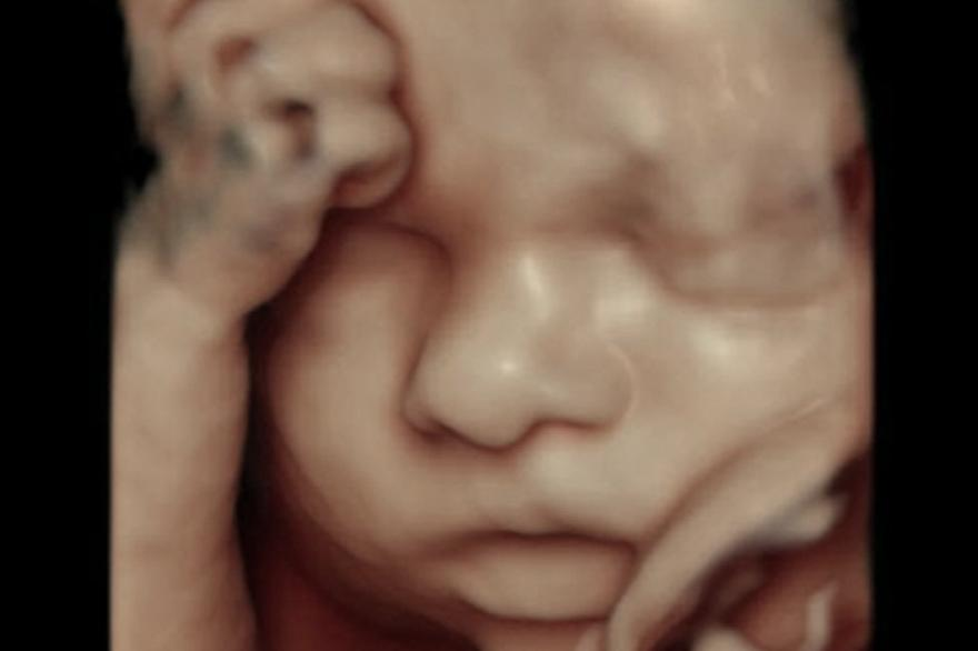 Badania prenatalne