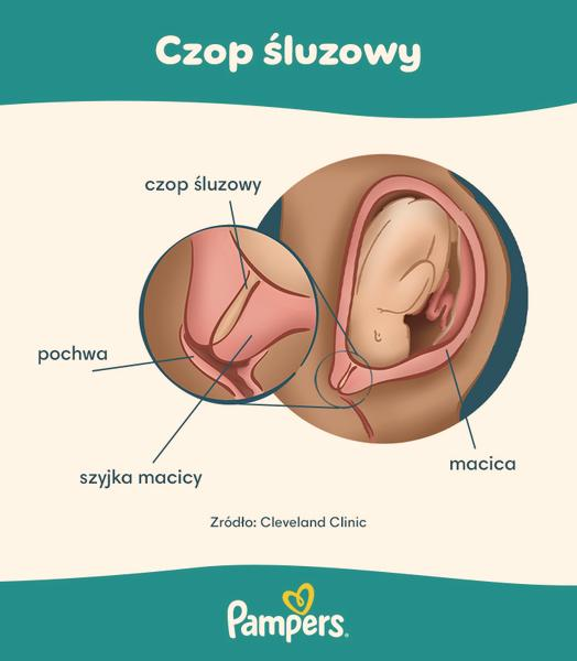 Czop śluzowy z krwią