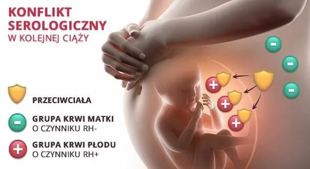 Czynniki Rh w ciąży