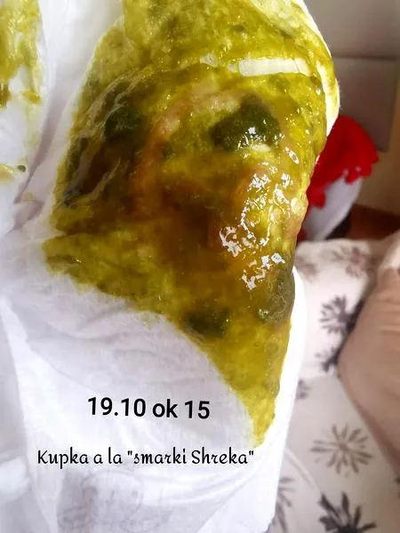 Kolor stolca noworodka