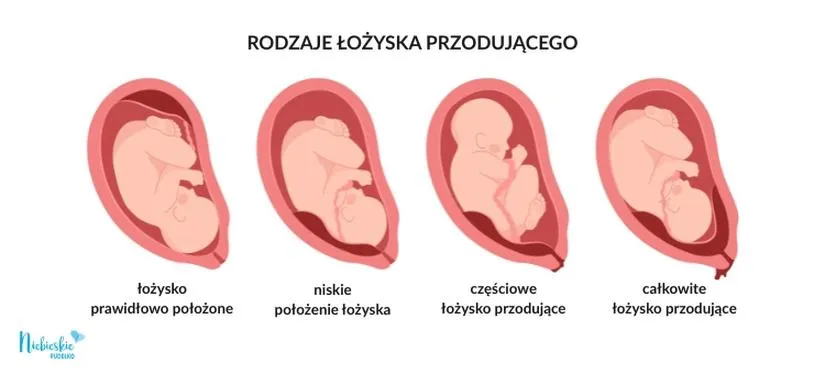 Łożysko przodujące