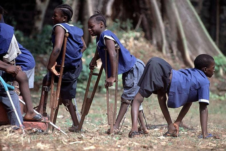 Polio u dzieci