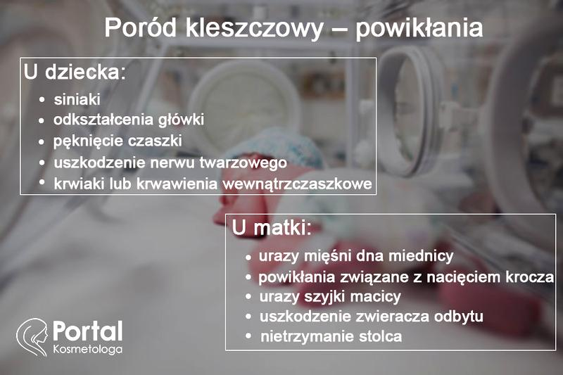 Poród zabiegowy