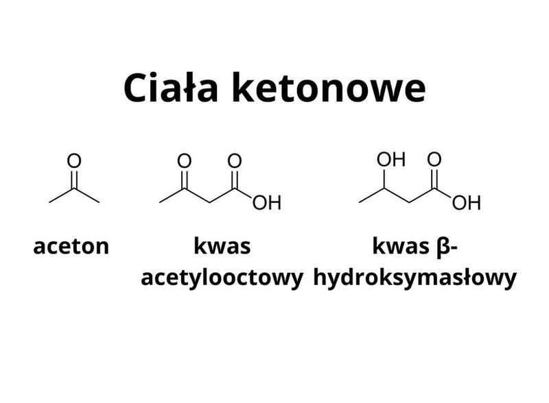 Przyczyny ciał ketonowych