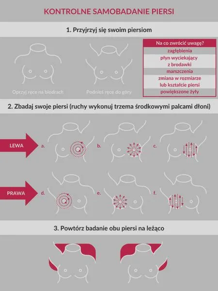 Swędzenie piersi